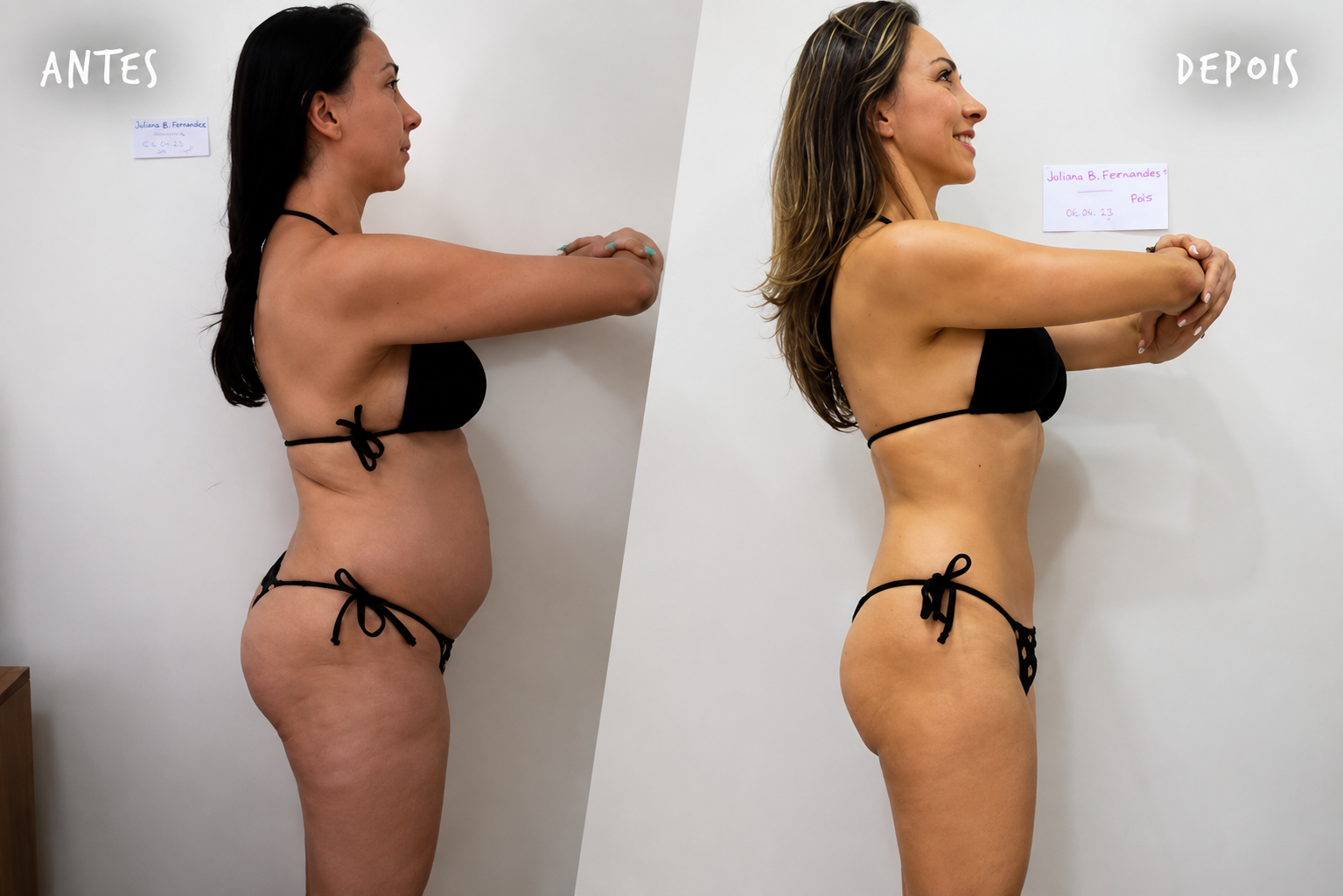 Antes e depois de perfil, redução de medidas
